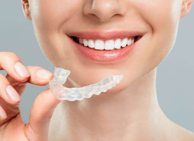 invisalign