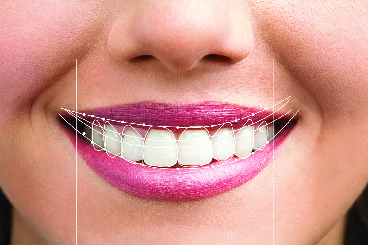 cosmetic-dentistry-smile-designing
